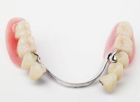 Image of Partial Dentures