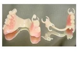 Image of Partial Dentures
